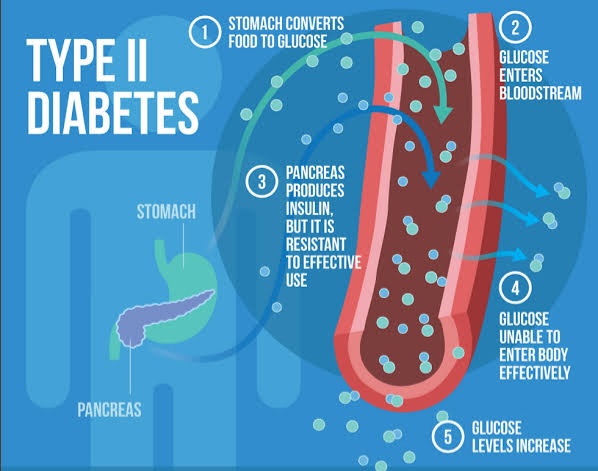 TYPE 2 DIABETES