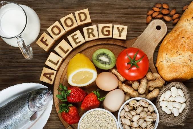 FOOD ALLERGIES